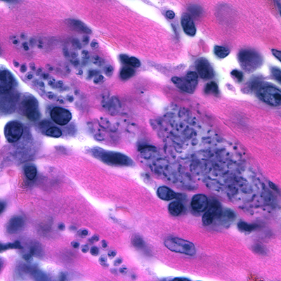 A CDC microbiologist was looking through slide boxes that had been archived to determine whether the slide quality was good enough to continue storing them. He came across a pathology slide of heart tissue that was dated "1929." 