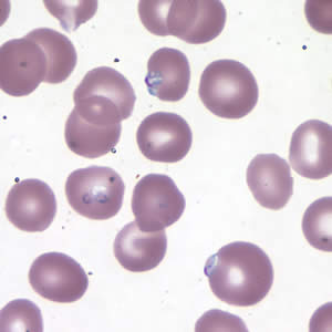 Case177_B.jpg Figure B