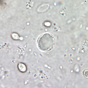A 29-year-old man went to a local health clinic with complaints of intermittent diarrhea for a few months. He did not report any other symptoms but said he had difficulty sleeping sometimes. 