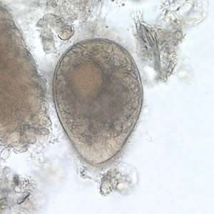 A group of refugees from Southeast Asia were being screened for parasites as part of a medical evaluation. Stool specimens were collected and processed. 
