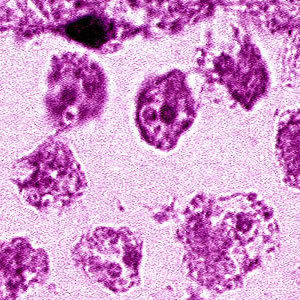 Case181_B.jpg Figure B