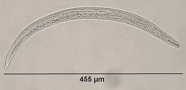 Case182_A.jpg Figure A