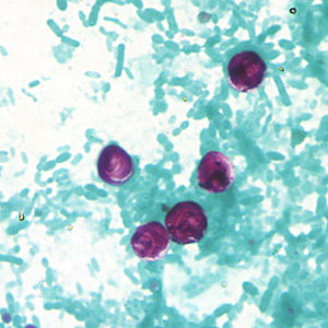 A family visited different U.S. states during a one week vacation. Approximately eight days after their trip, two family members began experiencing diarrhea. 