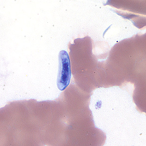 A patient went to a local hospital with fevers and thrombocytopenia after recent travel to Haiti. A blood smear examination was requested by the attending physician. 