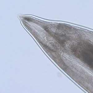 Case185_B.jpg Figure B