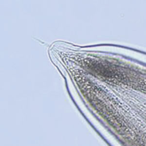 Case185_C.jpg Figure C