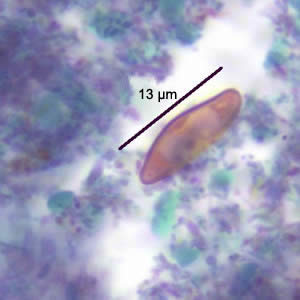 Case186_B.jpg Figure B