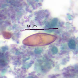 Case186_C.jpg Figure C