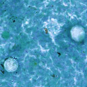 Case187_B.jpg Image B