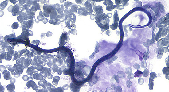 Case188_B.jpg Figure B