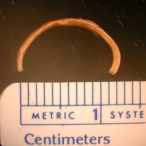 A 4-year-old boy's parents discovered a worm that they thought had been spit out by their child. They submitted the worm to their physician, along with the information that the boy had some exposure to raw seafood and that the family had a dog. 