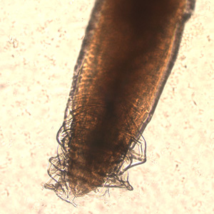 Case189_B.jpg Case189_B