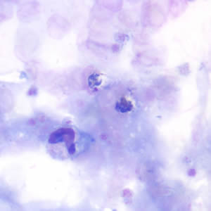 Case190_B.jpg Figure B