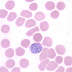 Case190_D.jpg Figure D