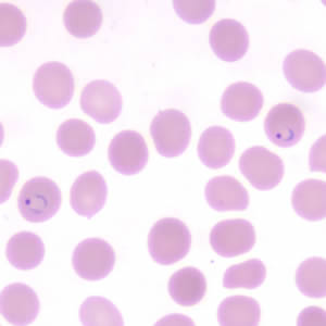 Case190_E.jpg Figure E