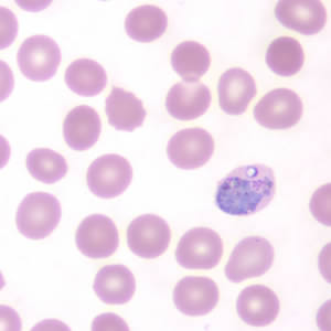 Case190_F.jpg Figure F