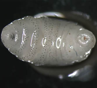 November - 2006 - Case #191 DPDx Telediagnosis Assistance received a request for confirmation of an identification by the Vermont Department of Health Laboratory. Figures A and B show an object that was extracted from a chest wound of a patient.