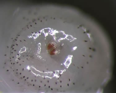 Case191_B.jpg Figure B