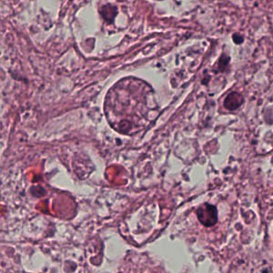 Case192_B.jpg Figure B