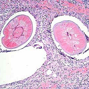 Case193_B.jpg Figure B