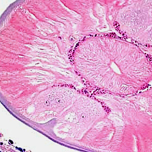 Case193_C.jpg Figure C
