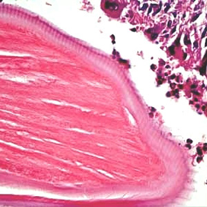 Case193_D.jpg Figure D