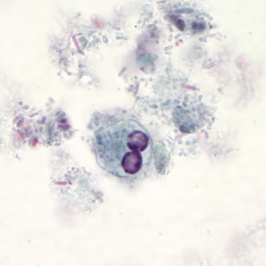 Case194_B.jpg Figure B