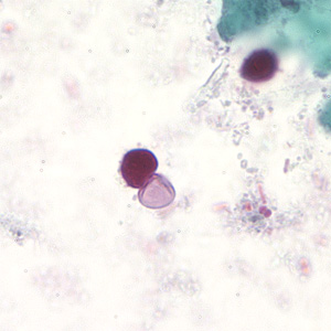 Case194_C.jpg Figure C