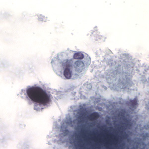 Case194_D.jpg Figure D