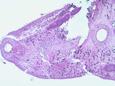 Case195_B.jpg Case195