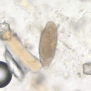 Case196_A.jpg Case196