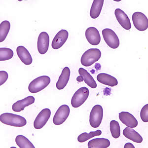 The Division of Parasitic Diseases' reference diagnostic laboratory received a specimen from a state health department for confirmatory review. The only patient information given was that the patient had traveled to Nigeria.