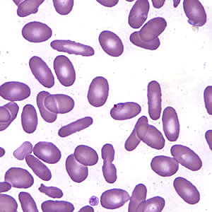 Case197_B.jpg Case197