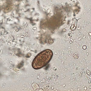 A 28-year-old male immigrant who had resided in Spain for the last five years, went to a physician complaining of general malaise and itching. The patient had slight eosinophilia but 15 days later was asymptomatic with no alteration in the differential blood count.
