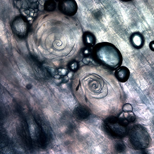 Case199_B.jpg Figure B