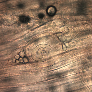 Case199_D.jpg Figure D