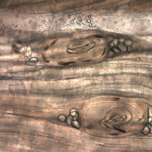 Case199_E.jpg Figure E