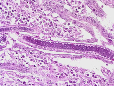 Case201_B.jpg Figure B