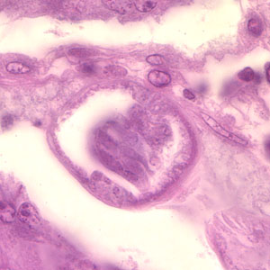 Case201_C.jpg Figure C