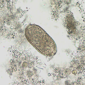 Case201_D.jpg Figure D