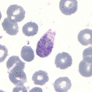 Case202_B.jpg Case202