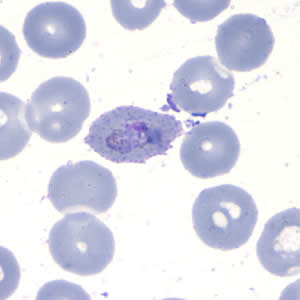 Case202_D.jpg Case202