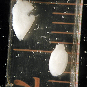 A mother found objects that she thought were maggots in the diaper of her 10-month-old child. She submitted the specimens to her state health department for identification and advice. 