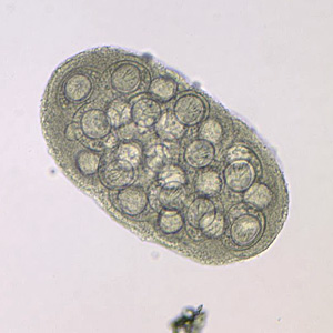 Case204_C.jpg Case204