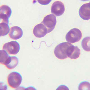 Case205_D.jpg Case205