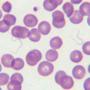 Case205_E.jpg Case205