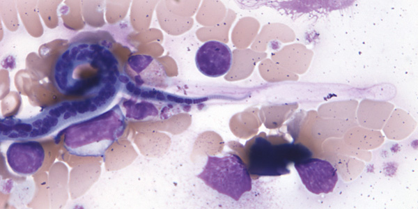 Case206_B.jpg Figure B