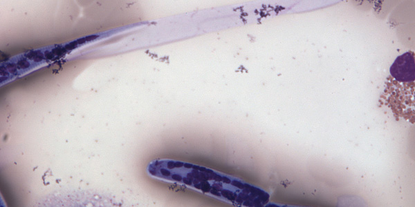 Case206_D.jpg Figure D