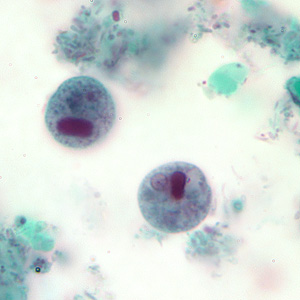 Case207_B.jpg Figure B