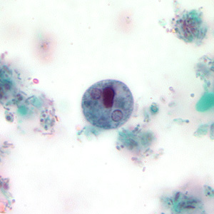 Case207_C.jpg Figure C